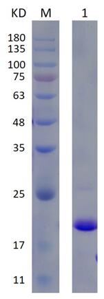 12% SDS-PAGE analysis profiles of purified KP1_0355-22-117 (CBB stained).